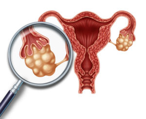 ovaries concept and uterus with fallopian tubes as a magnification close up of a human female reproduction illustration on a white background as a symbol of fertility and reproductive system health.